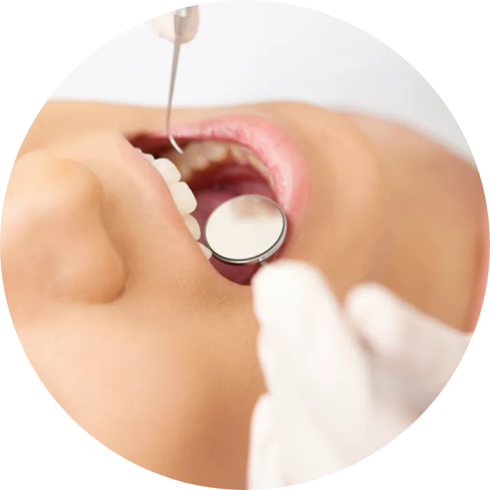 予防歯科・歯科ドック