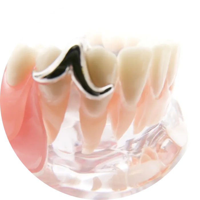 入れ歯・ブリッヂ